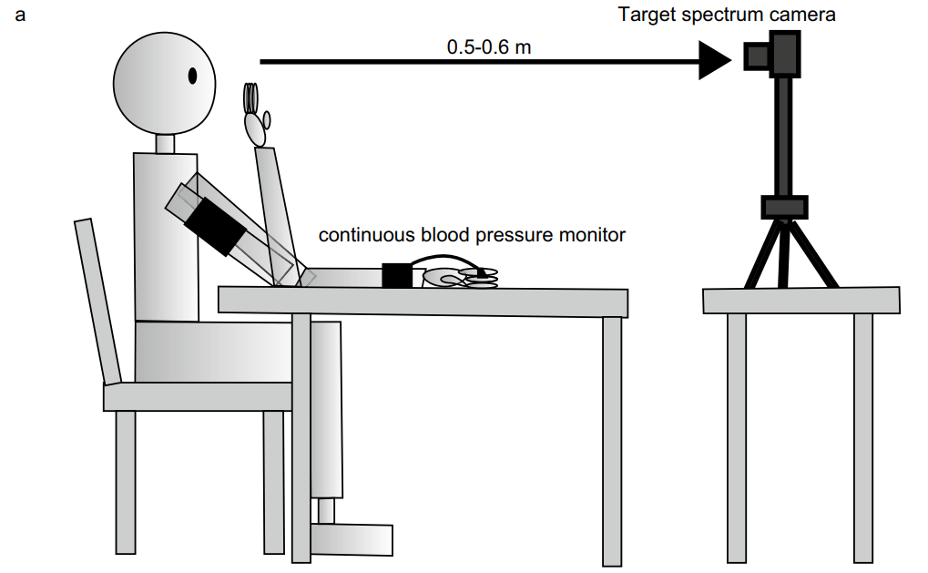 Data acquisition and spectral reflectance analysis. Subjects’ palms and faces were imaged using a high-speed target spectral camera concurrently with the measurement of blood pressure (BP) using a continuous BP monitor (CNAP). The distance between the camera and the subject was maintained within the range of 50 to 60 cm. Illumination was provided solely by the standard lighting fixtures available in a hospital room.