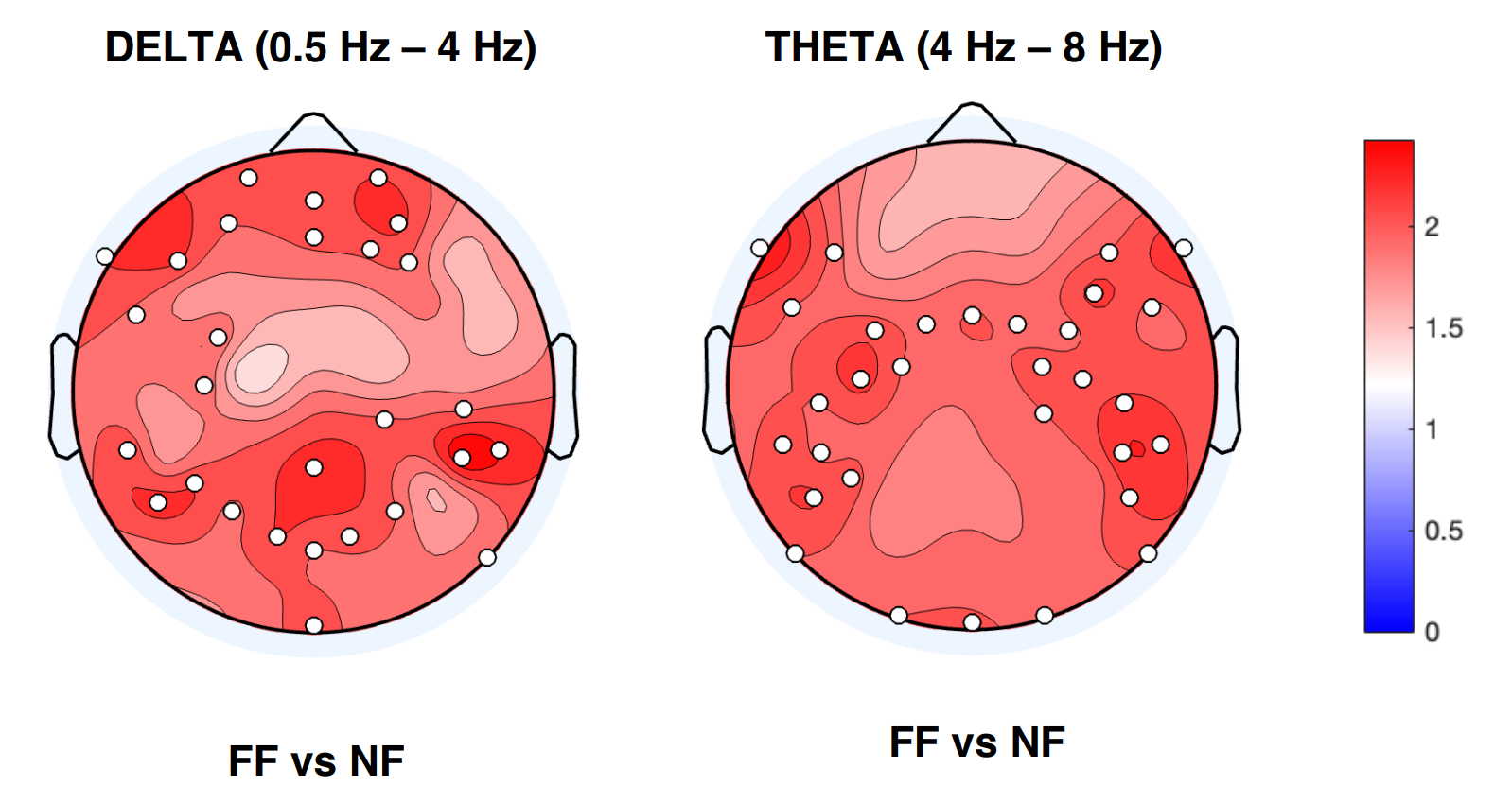 Differences in low-frequency activity variations after T2. The topographic plots show the statistical comparison between experimental conditions (FF vs NF) for delta and theta frequency bands at time T2 after subjects completed the economic games block.