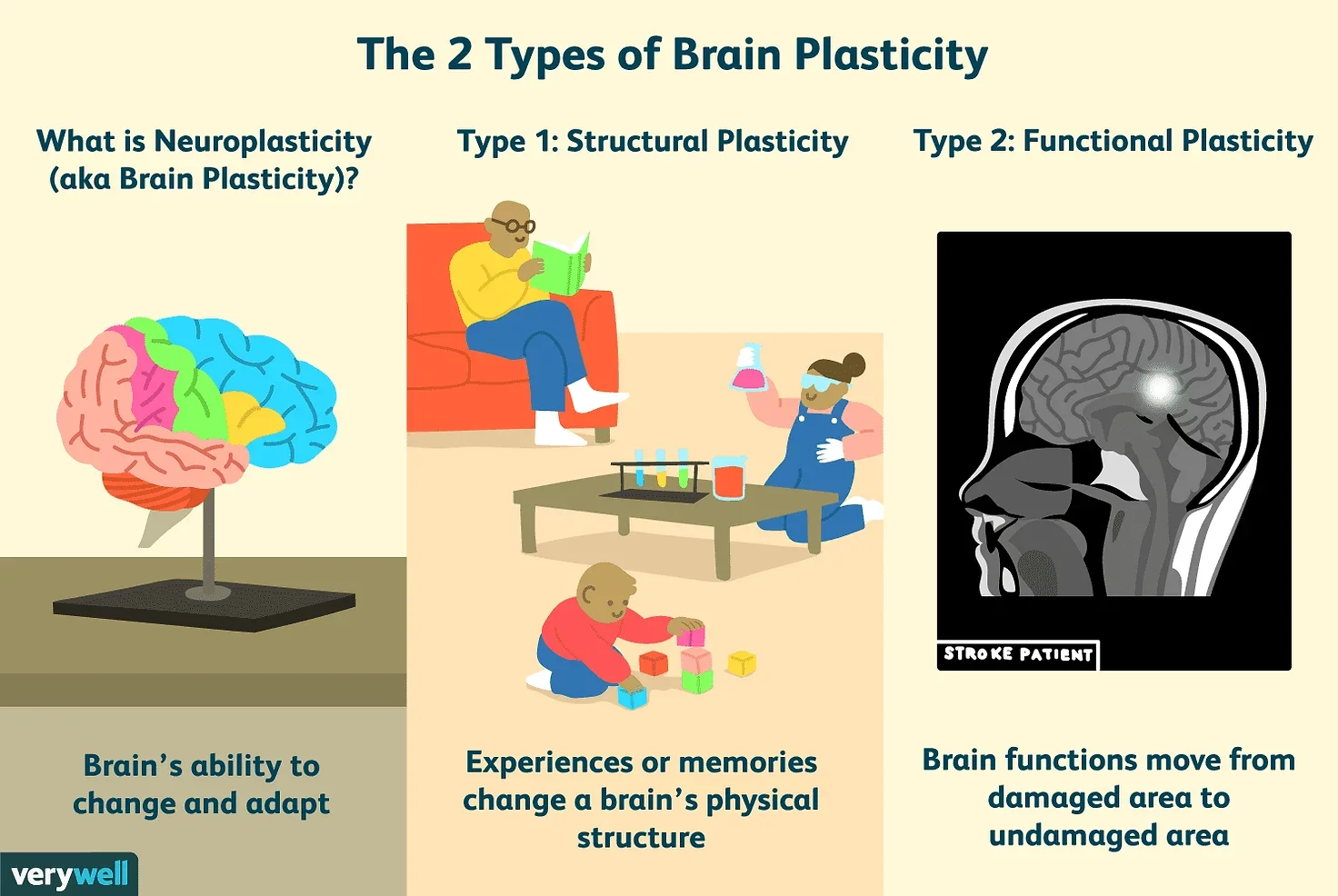 What is Neuroplasticity?