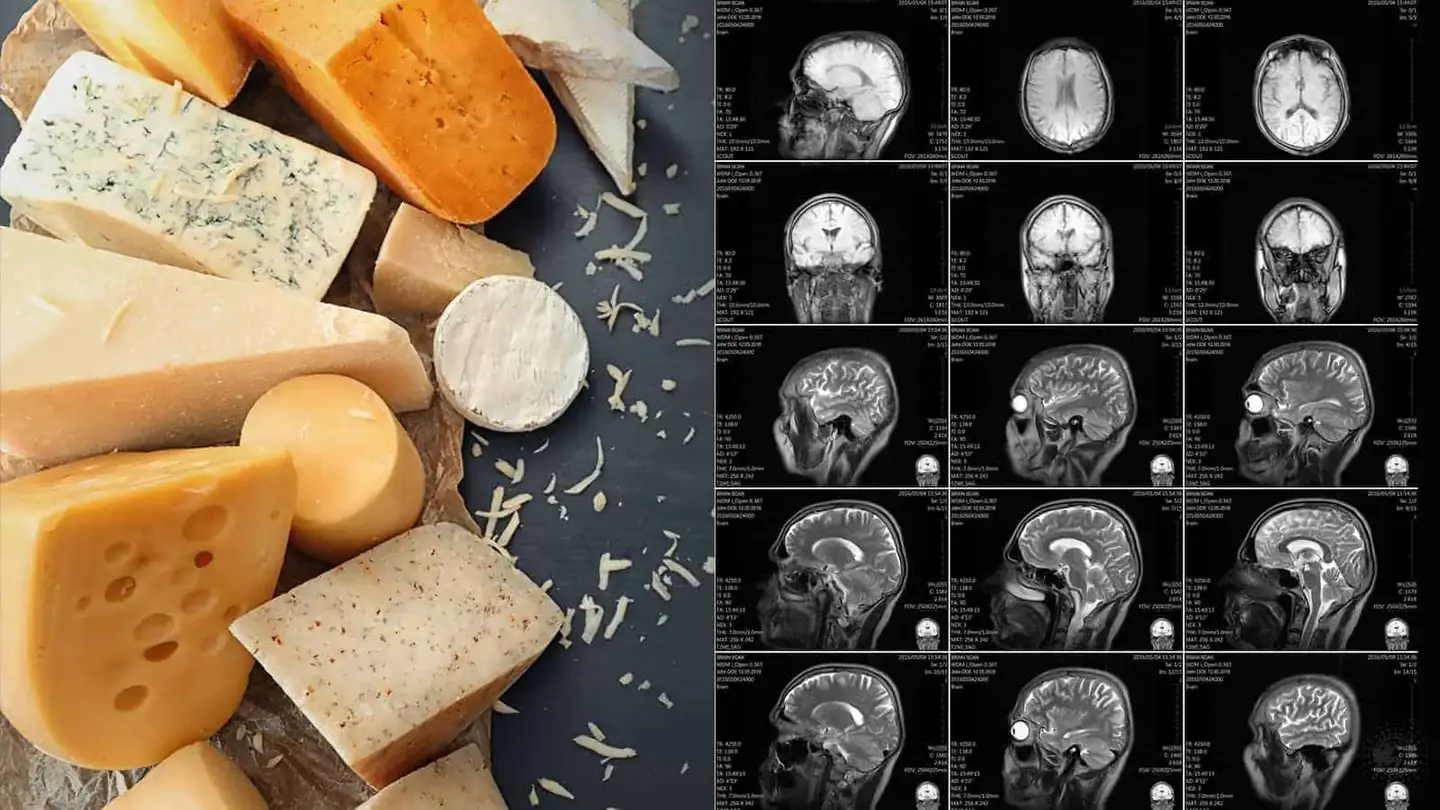 High intake of dairy products like milk and cheese, particularly in midlife, has been linked to reduced risks of dementia, including Alzheimer’s.