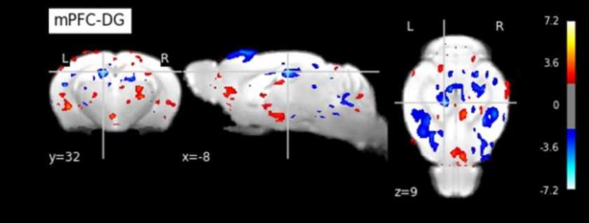 An MRI of the hippocampus and the pre-frontal cortex when the Tob gene was removed. This MRI allowed the researchers to determine that the connectivity between the hippocampus and the pre-frontal cortex had been altered. The image is from the press release "Jumping gene found to be strongly linked to depression, fear, and anxiety."