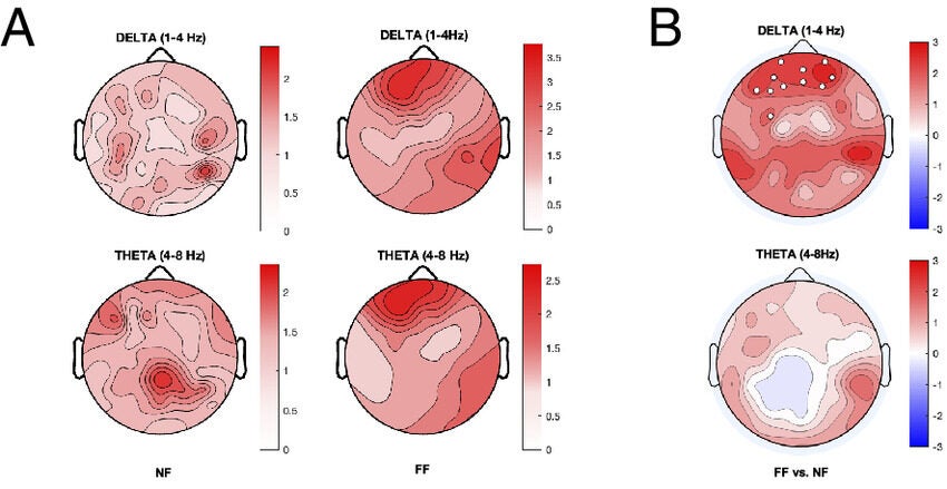 Panel shows low-frequency EEG activity changes associated with the FF and NF experimental conditions.