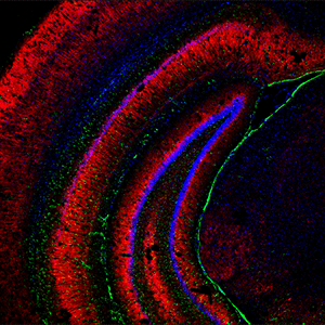 Cerebral hippocampus, one of the areas mainly affected by neurodegeneration processes in Alzheimer's disease and the object of the study