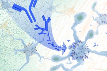 Antibody treatment blocked interaction between APOE proteins and LILRB4 receptors in the brain, enabling microglia immune cells to clear amyloid plaques, a feature of Alzheimer’s. 