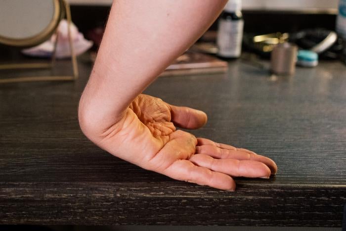 A wrist can be bent much further than we imagine. 