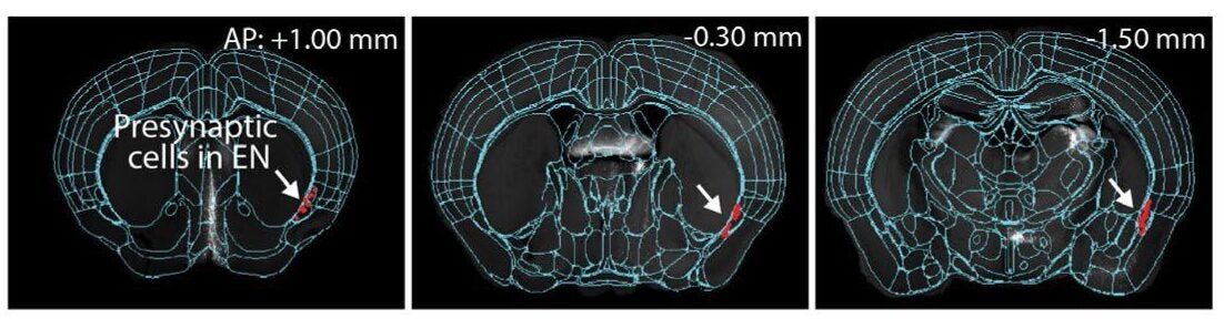 Example images showing presynaptic cells in EN (white arrow). 