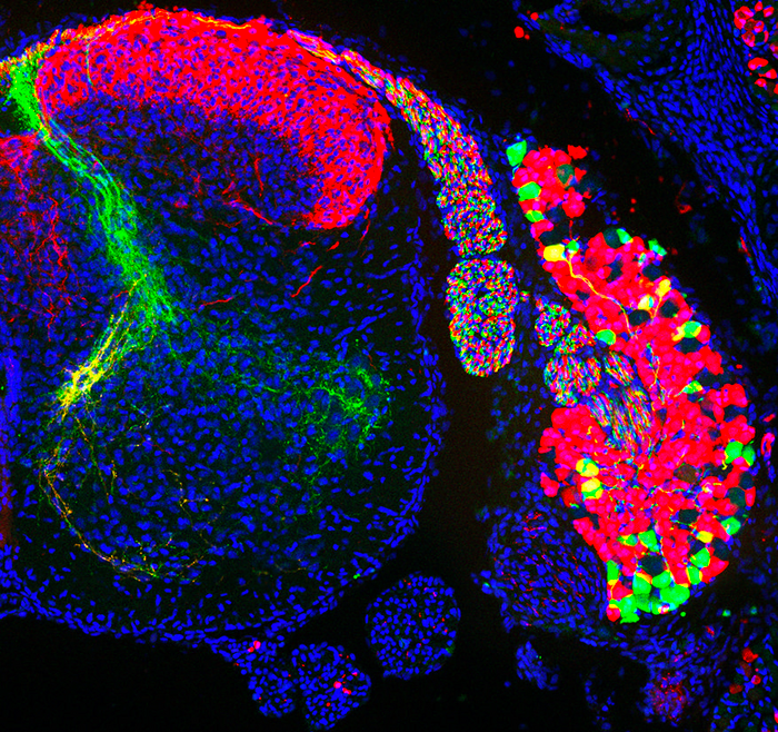 Different populations of sensory neurons cell bodies in a dorsal root ganglion (right) and their axons in the spinal cord (left): The cells in green detect proprioceptive information while the cells in red thermal and tactile information.