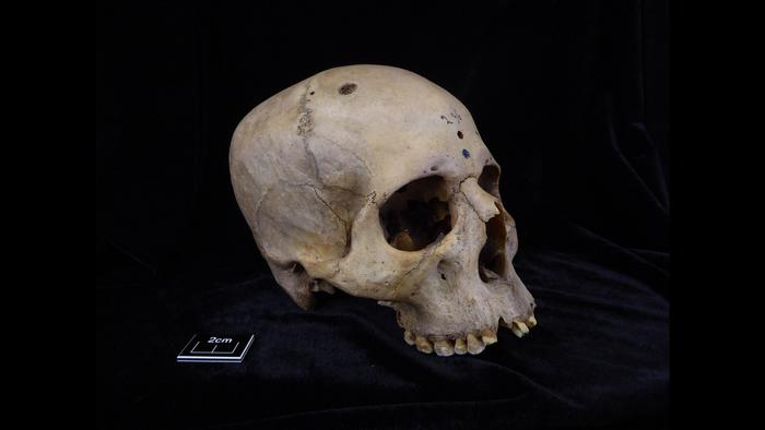Skull and mandible 236, dating from between 2687 and 2345 BCE, belonged to a male individual aged 30 to 35.