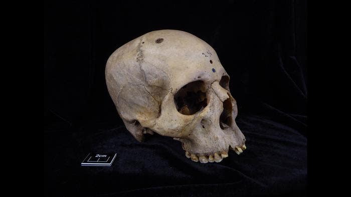 【希少本】Cranial Technique 1979-1980 Transcochlear Approach | Jackler Collection | Volumes | The