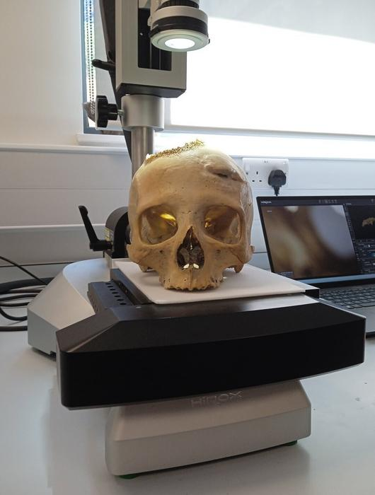 The skulls were examined using microscopic analysis and CT scanning. 