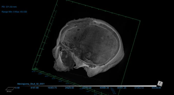 The skulls were examined using microscopic analysis and CT scanning. 