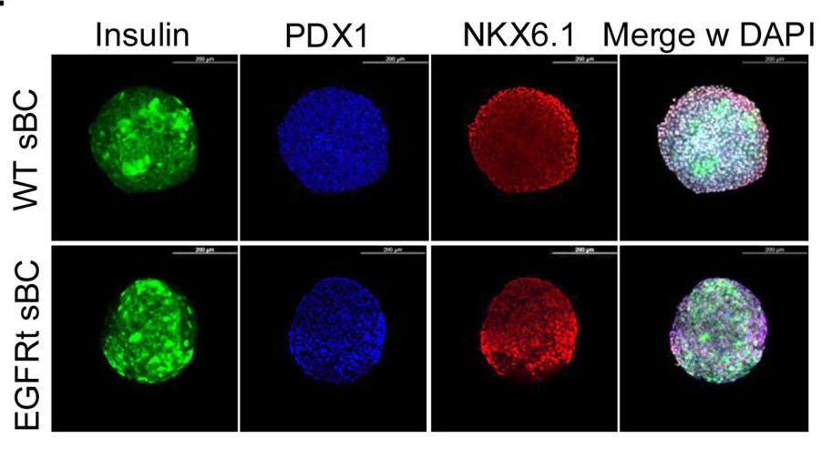 Immunofluorescence staining of day 23 WT and EGFRt-sBCs for insulin (green), PDX1 (blue), and NKX6.1 (red) merged with DAPI (white). Scale bars represent 200 μm.