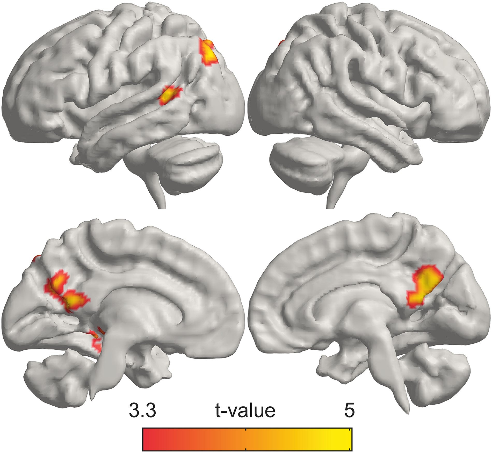 Brain regions activated more strongly in pet owners than participants without pets in love for pets vs. control contrast. 