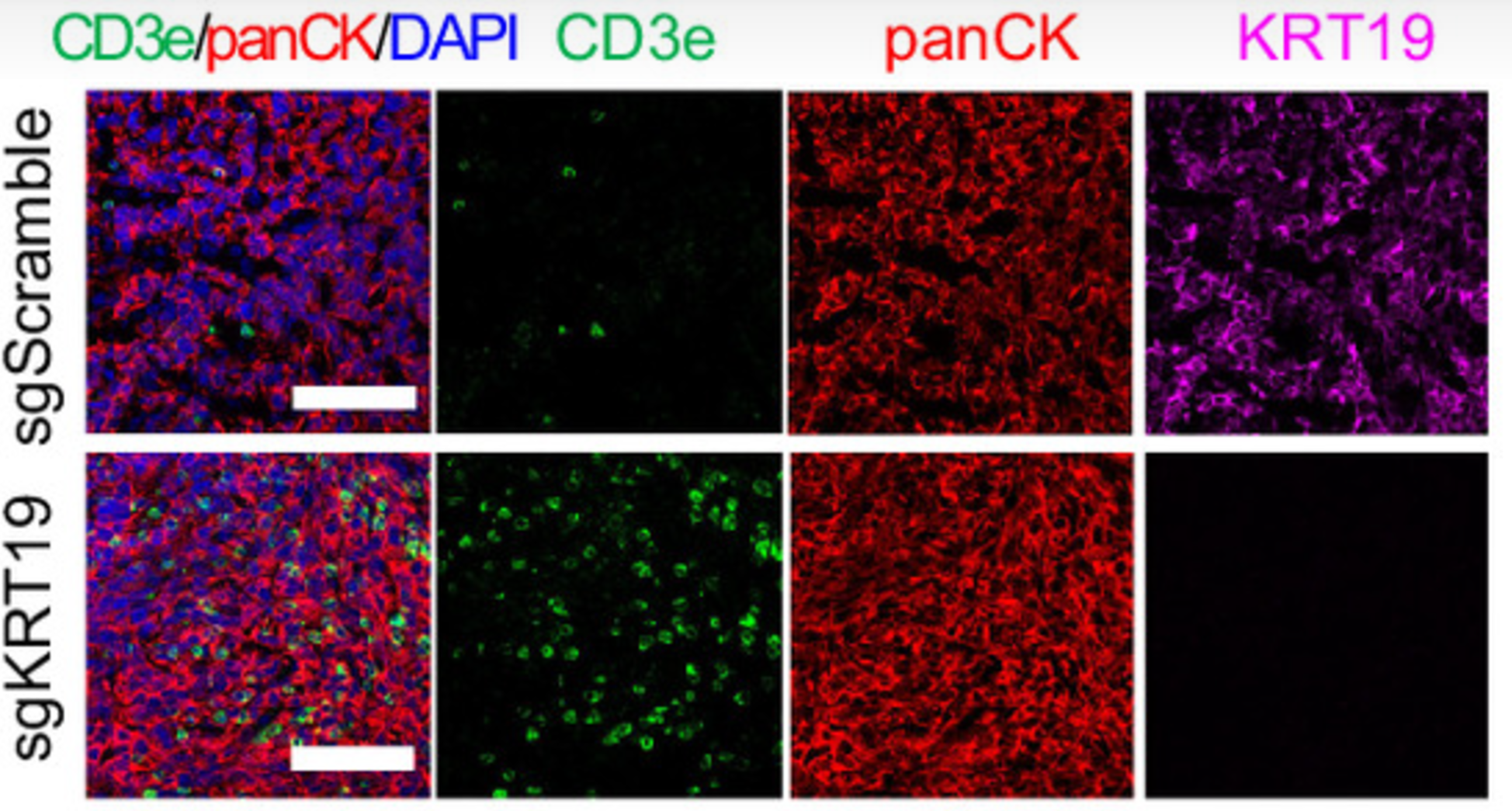 Representative immunofluorescent images show CD3e+ T cells in the center of one sgKRT19-edited and sgScramble-control orthotopic tumor on day 14.