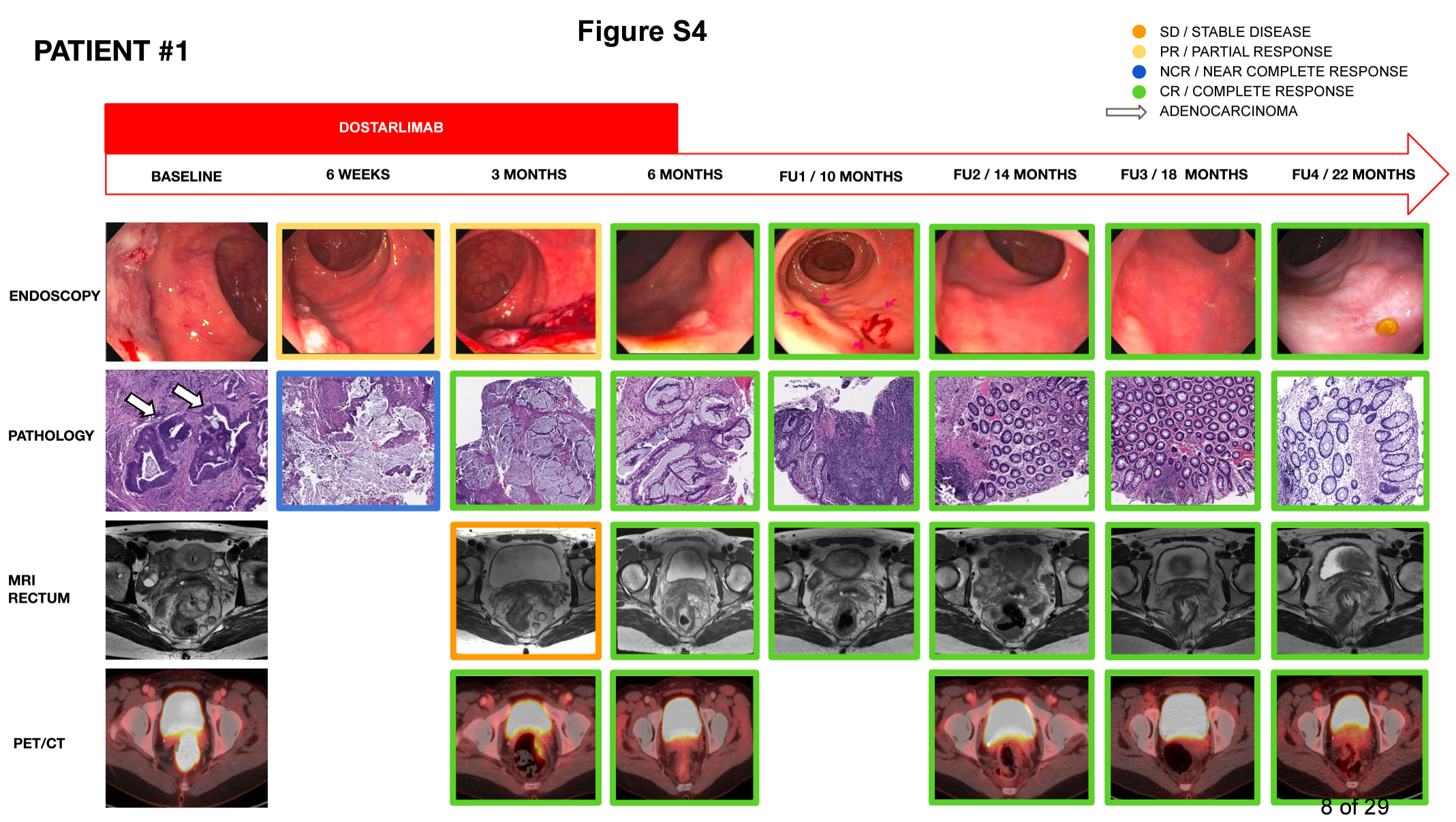  Individual patient longitudinal data (n=14). Depiction of individual longitudinal endoscopic, pathologic, rectal MRI and PET data at baseline, 6 weeks, 3 months, 6 months and in follow up. 