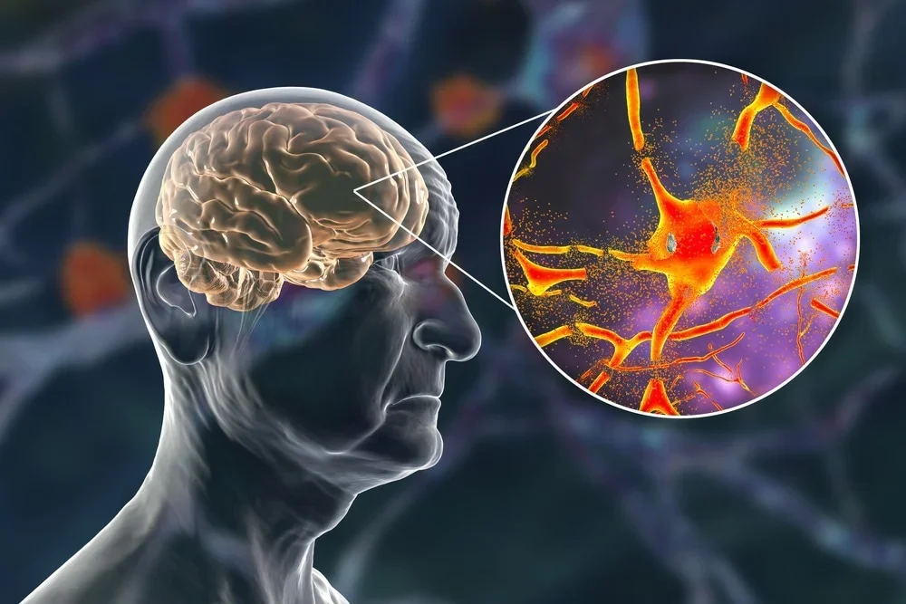 Socioeconomic inequality and pollution linked to accelerated brain aging