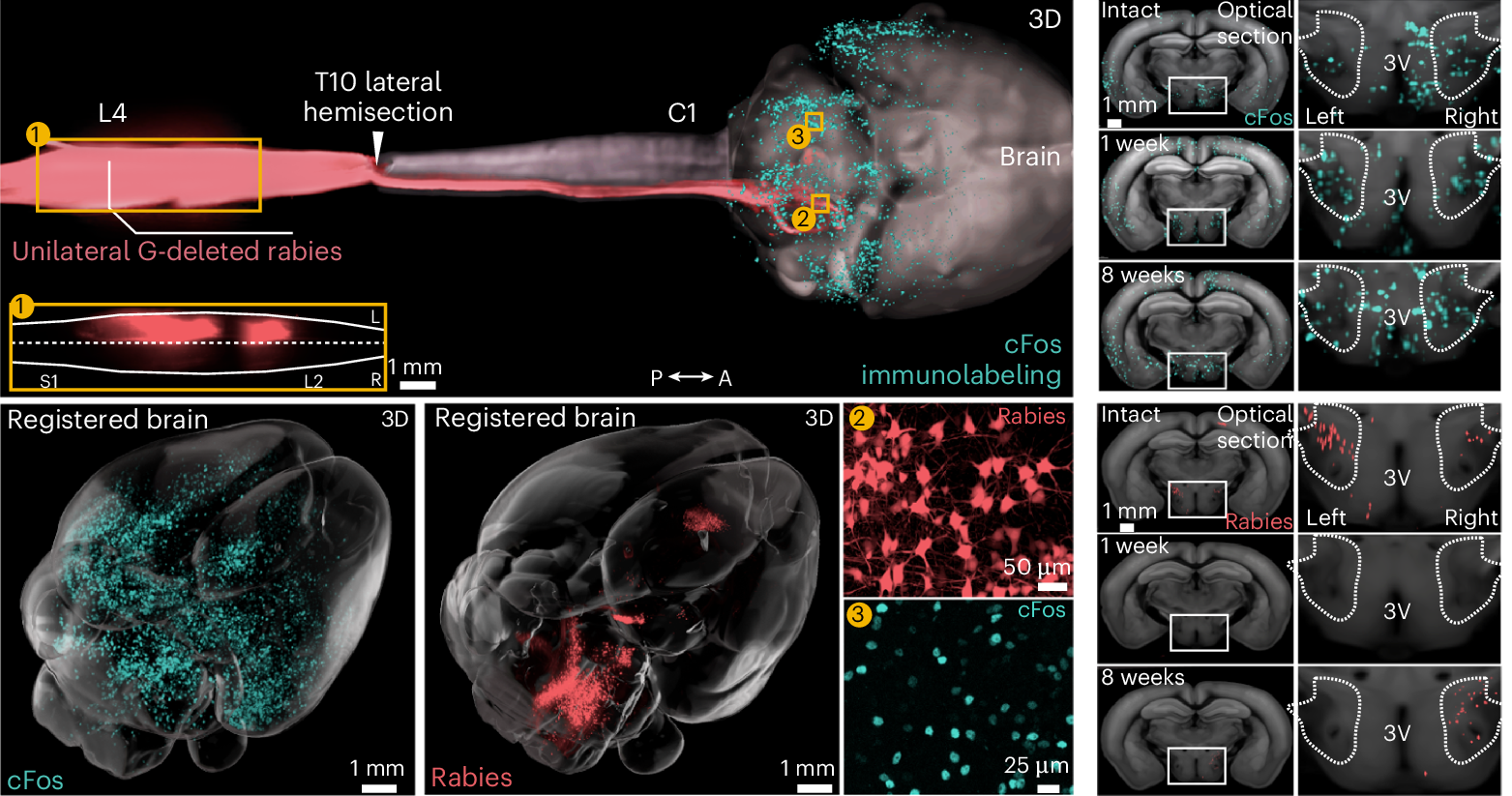 Space–time brain-wide atlas of recovery from SCI nominates the LH.