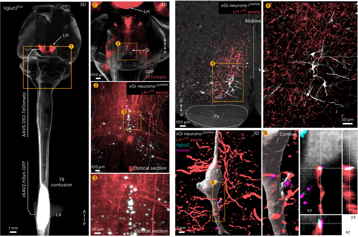 Neurons in the vGi relay signals from LHVglut2 neurons.