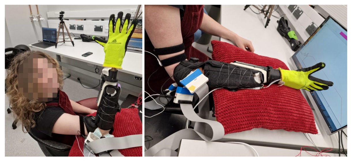 The full system integration showing the combination of HD-sEMG sensors on a soft socket, the soft multisynergistic hand, and the real-time neural synergistic control.
