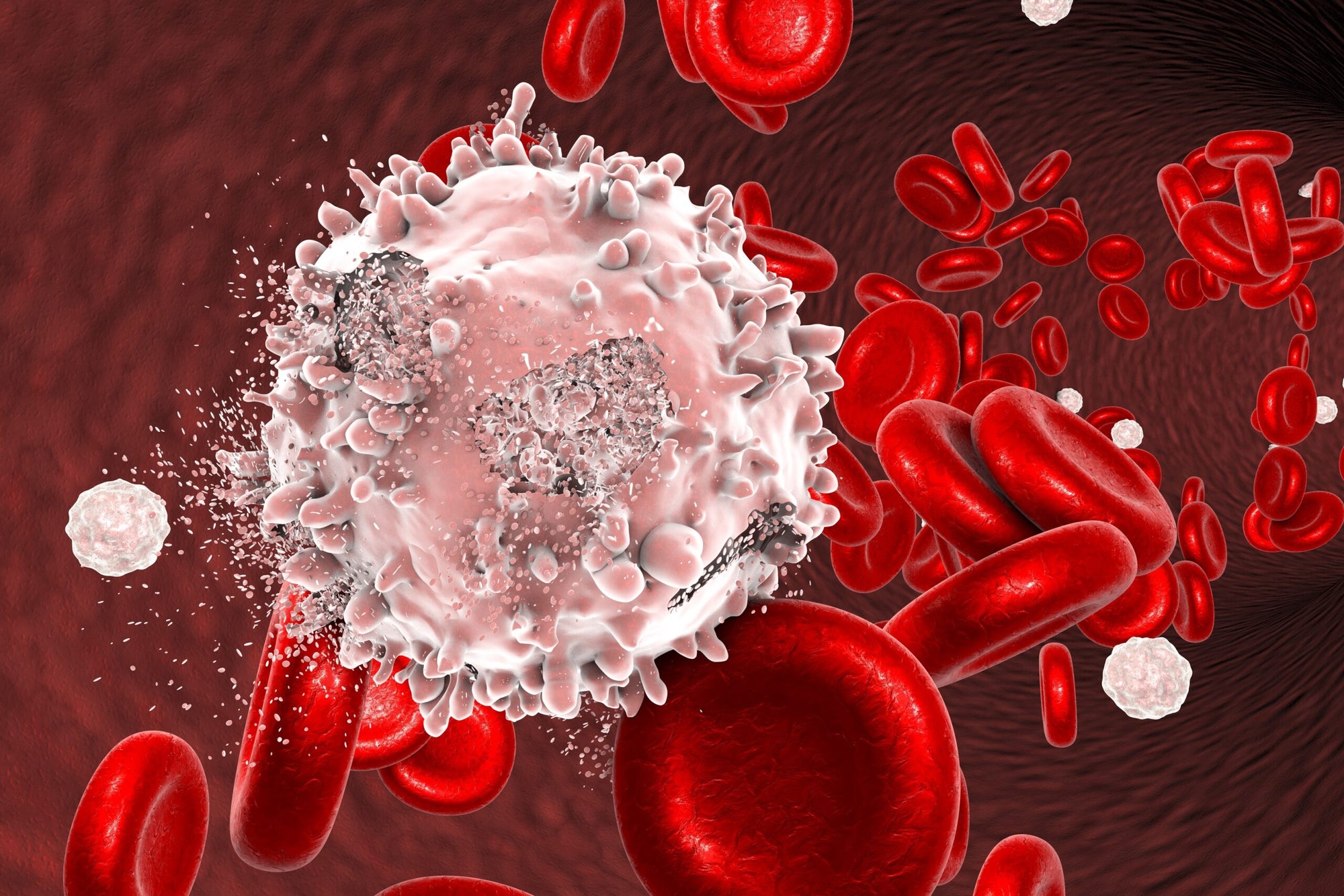 New discovery revolutionizes blood cancer treatment New discovery revolutionizes blood cancer treatment