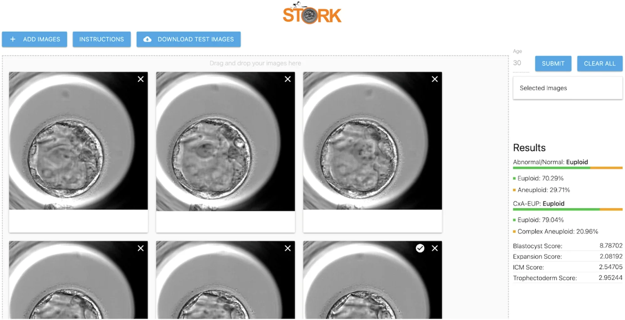 STORK-V web interface.