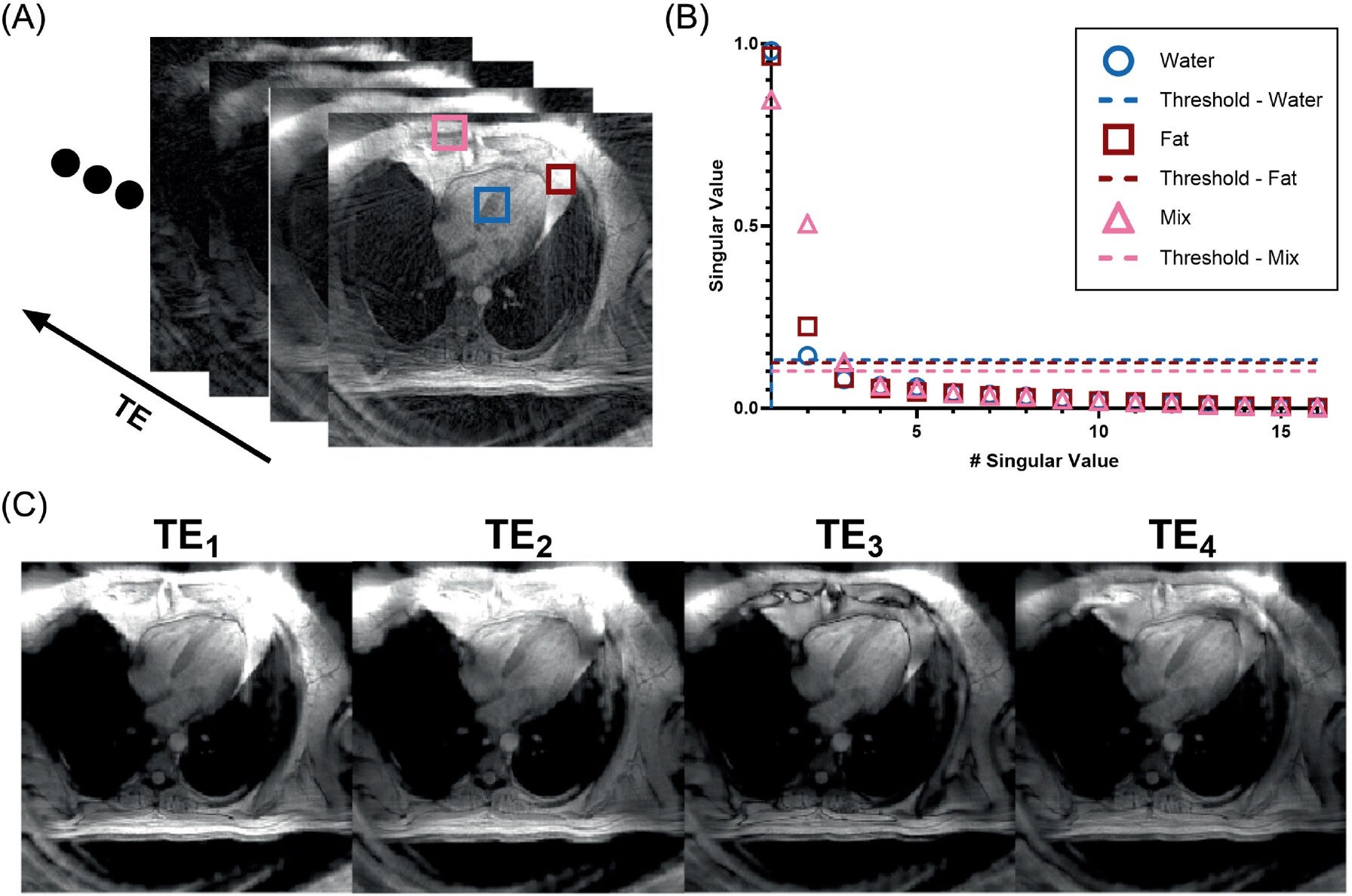 (A) Undersampled multi-echo gradient echo images with patches drawn over regions of varying water and fat content. (B) The singular values and cutoff thresholds calculated for each patch. (C) GRE images at the first four TEs after performing singular value thresholding showing reduction of streaking artifacts. GRE, gradient echo.