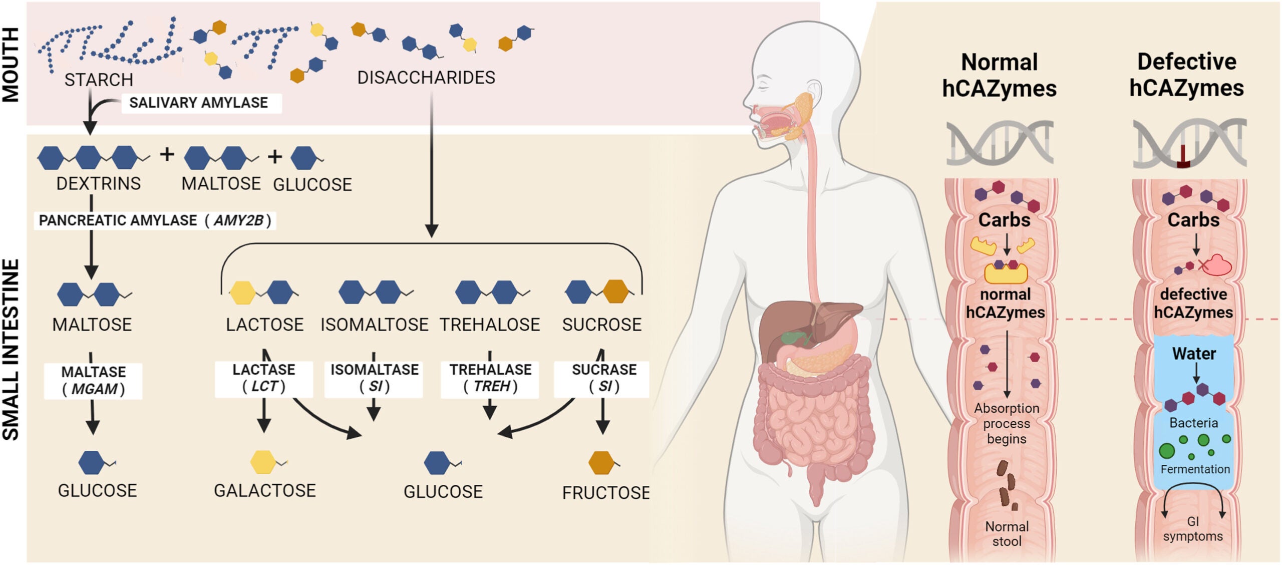 Graphical representation of the process of carbohydrate digestion in the gastrointestinal system, including defects in hCAZymes.