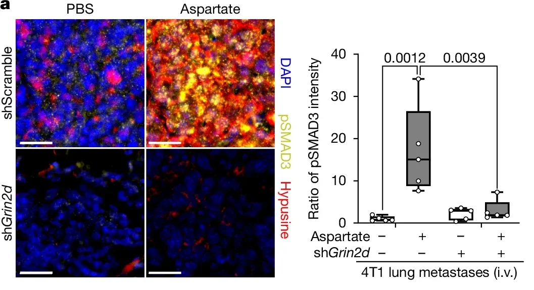 Alternative translation induced by eIF5A hypusination results in collagen synthesis.