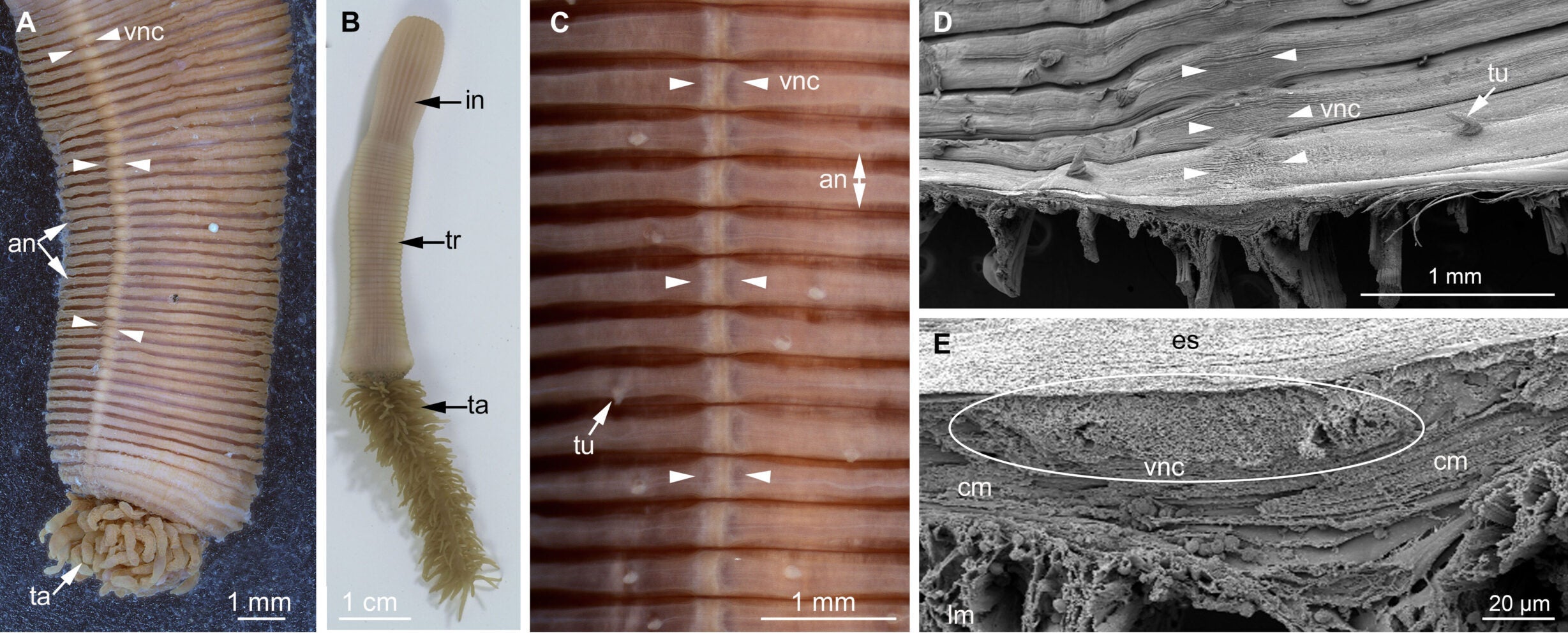 P. australis, posterior part showing annulated body and longitudinal VNC.