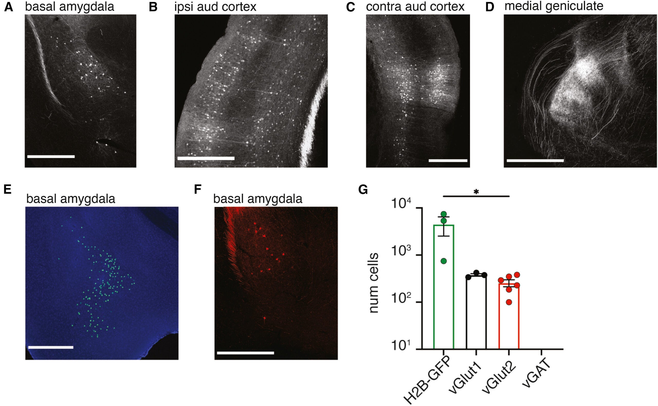 A subpopulation of glutamatergic neurons in the BA project to the AC