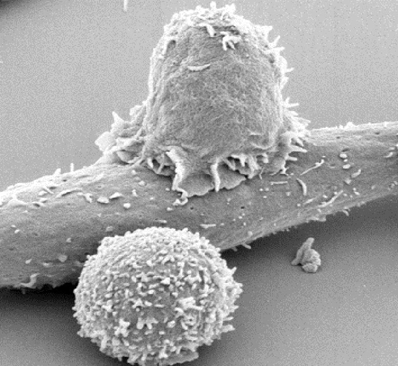 By shifting how T cells are cultured, researchers may be able to create more effective cell therapies with lasting immunity against cancer.