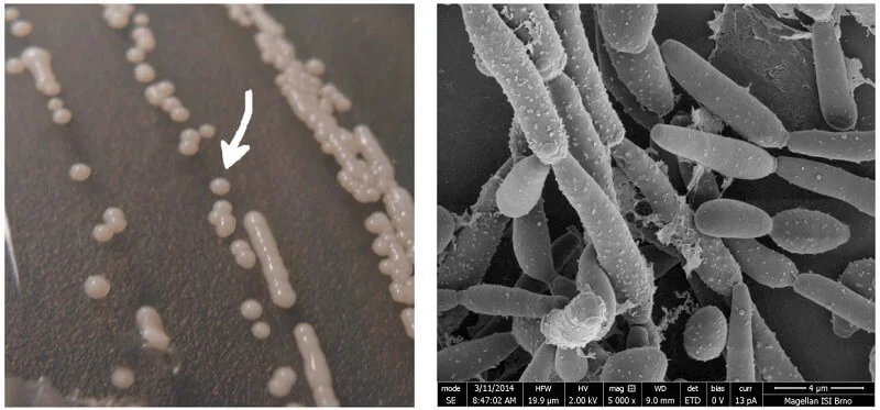Image of Candida parapsilosis colonies cultivated on agar for 48 h. The colony size is about 2 mm