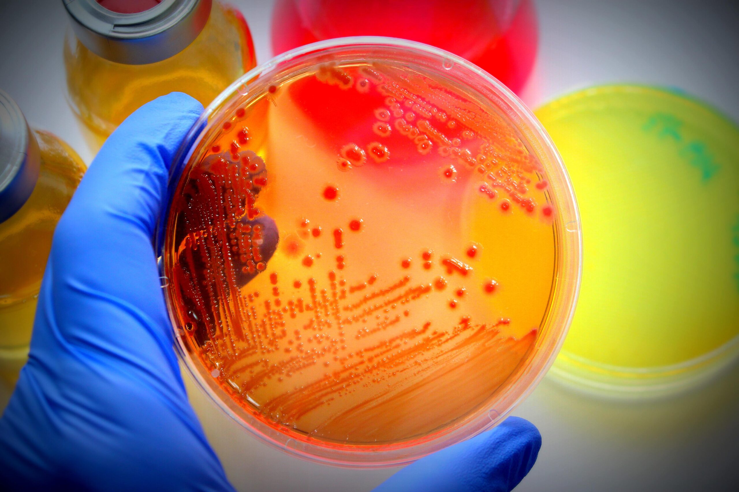 Escherichia coli (E Coli) can thrive on the rubber seals, filters, and crevices inside dishwashers.