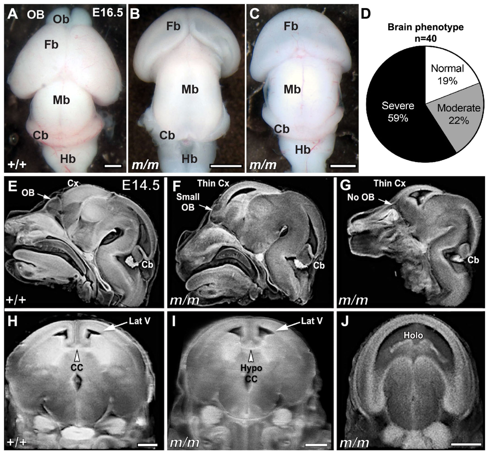 Ohiam/m mice display microcephaly with brain abnormalities. 