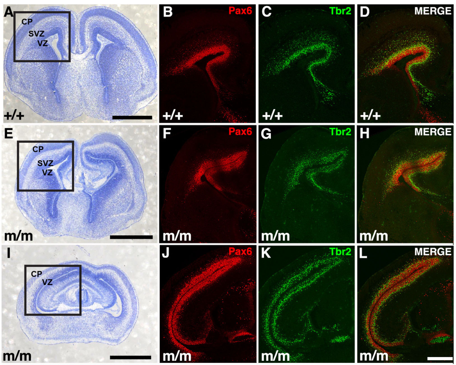 Impaired cortical plate formation with loss of Tbr2+ intermediate progenitors in Ohiam/m mutant brain.