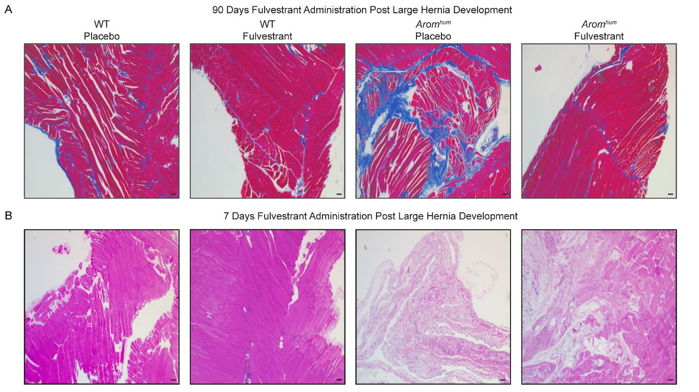 Representative images of LAM of mice after a (A) 90-day fulvestrant treatment from Figure 2B and (B) 7-day fulvestrant treatment. 