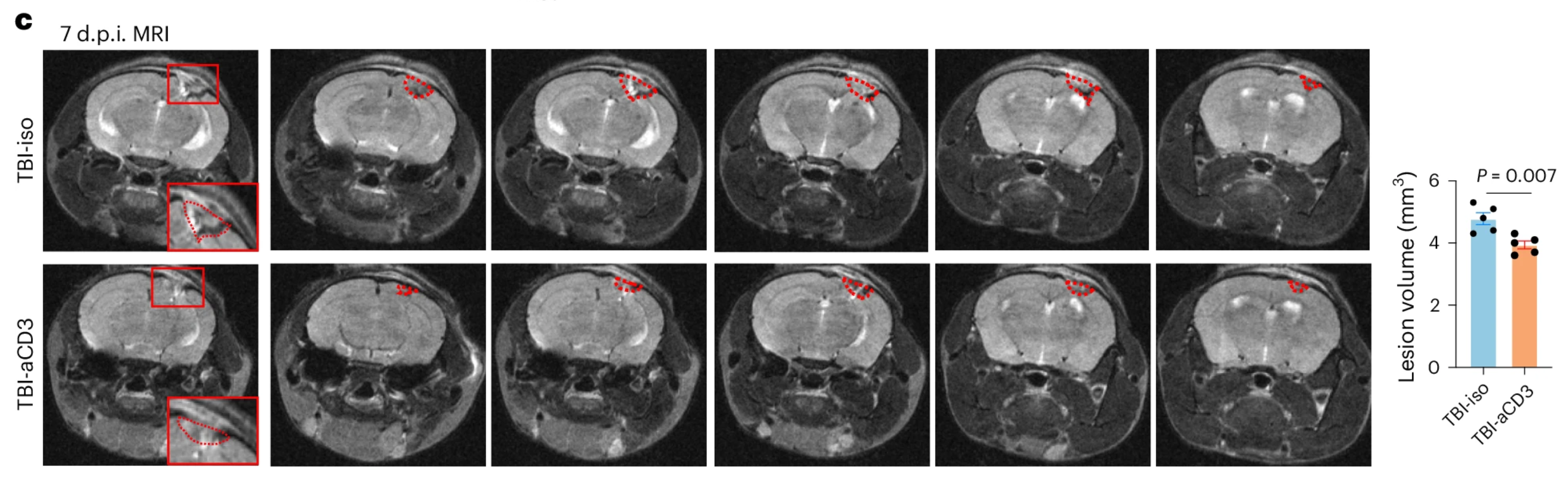 MRI lesion volume 7 d post-TBI (TBI-iso n = 5, TBI-aCD3 n = 5), analyzed by two-sided, unpaired Student’s t-test. Data are shown as mean ± s.e.m. The red dashes indicate the lesion area.