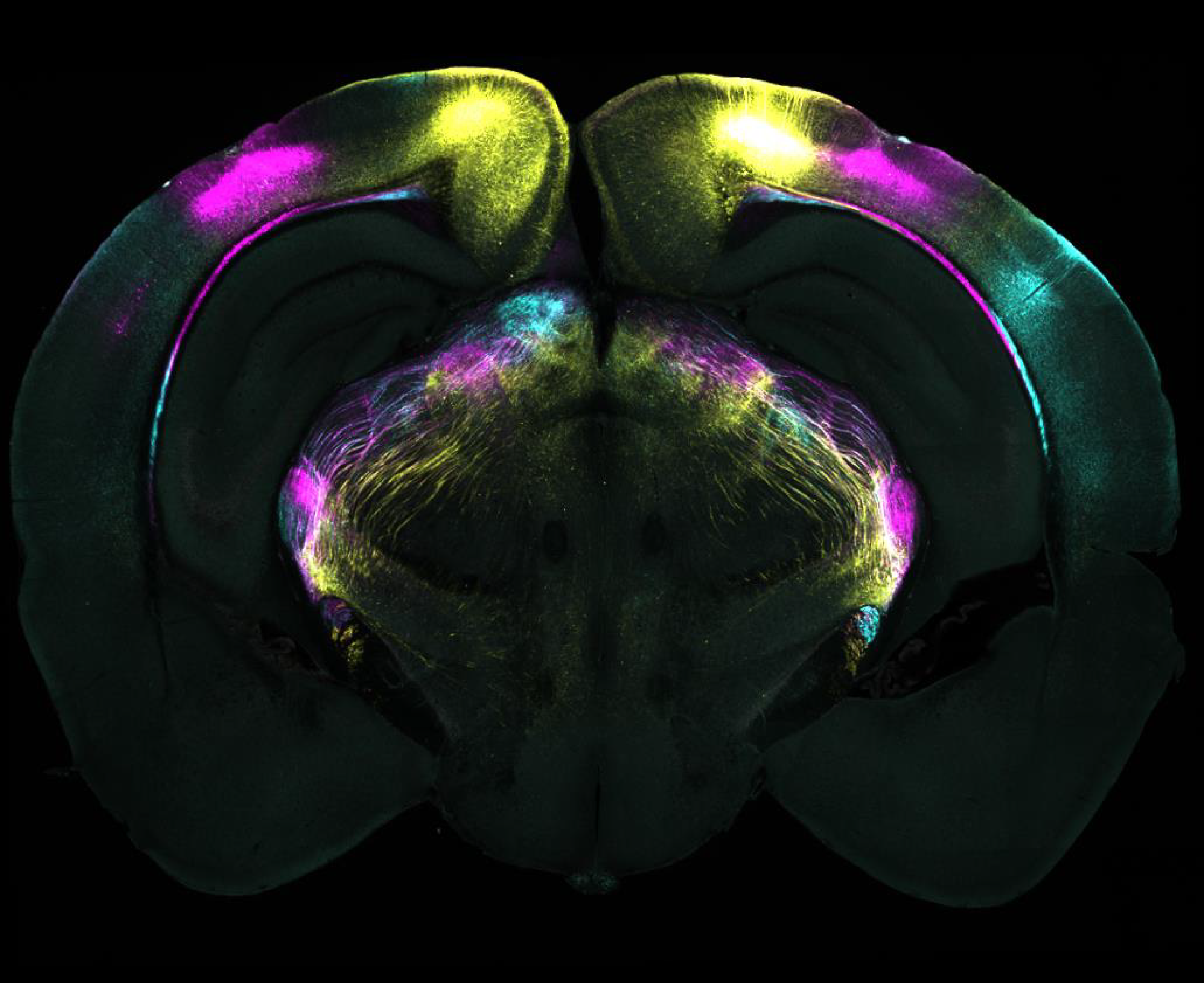 Coronal brain slice showing projections from different visual areas in the cerebral cortex to the ventrolateral geniculate nucleus (vLGN). These pathways are part of the circuit identified as mediating the suppression of instinctive fear responses.