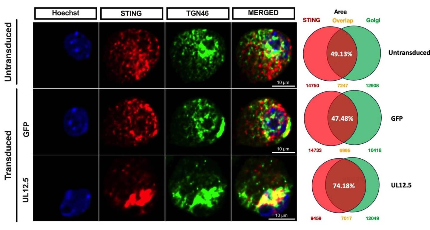 Representative immunofluorescence images of STING/pIRF3 at 3-days post transduction with either GFP or UL12.5 expressing lentiviral vector.