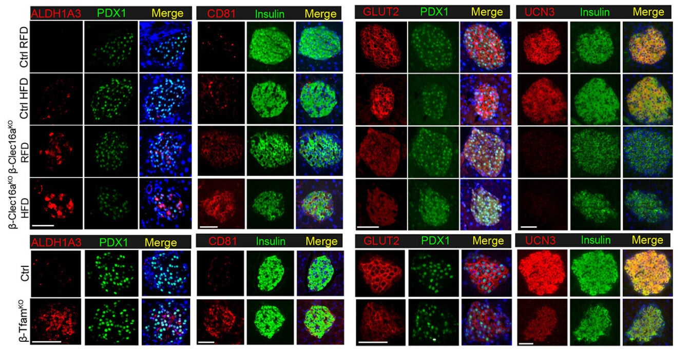 Immunofluorescence images for key β-cell dedifferentiation markers ALDH1A3 and CD81 (co-stained with PDX1 or insulin, respectively) from Ctrl and β-Clec16aKO mice (top) and Ctrl and β-TfamKO mice (bottom). n = 3-6/group.