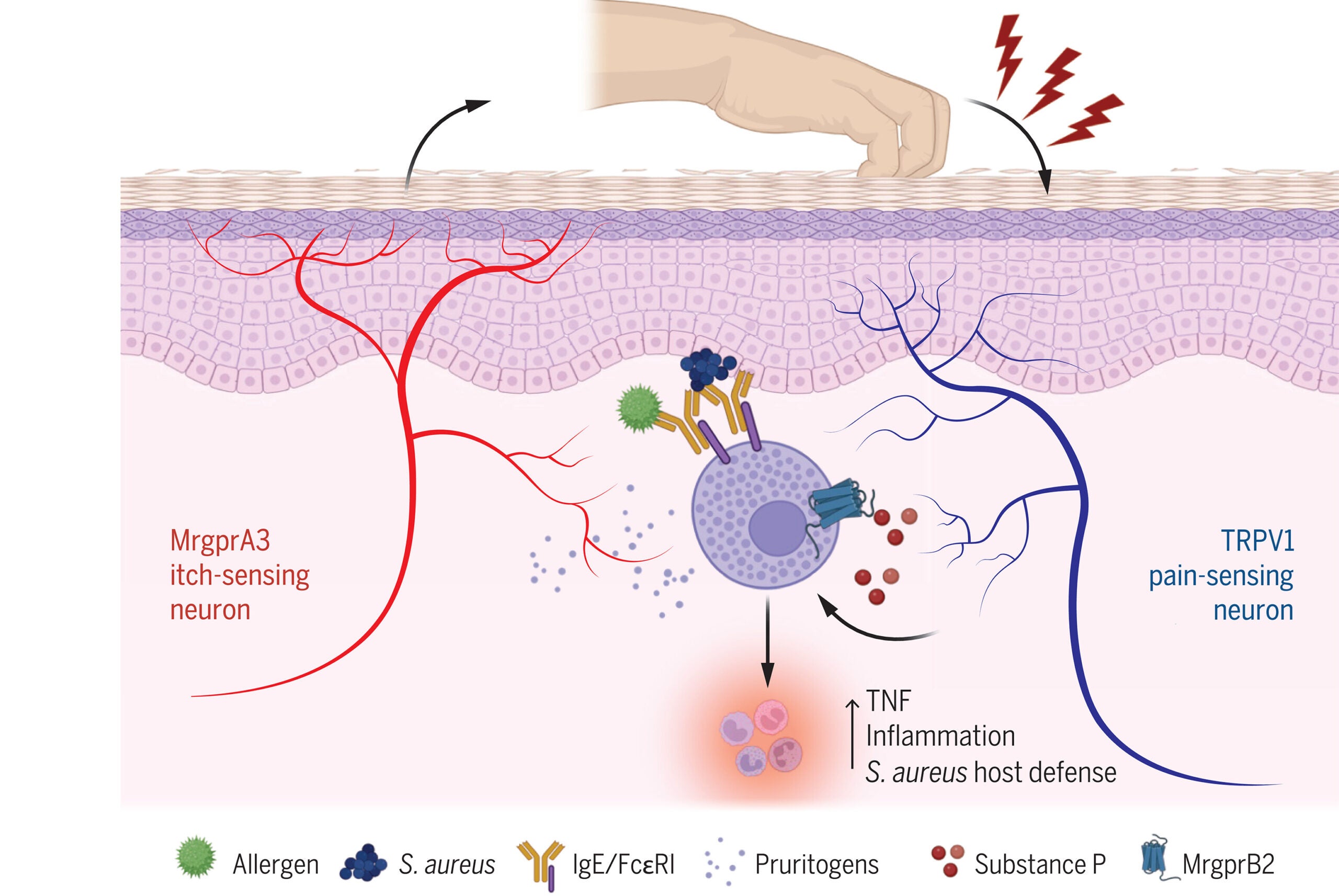 Scratching synergizes with FcεRI mast cell activation to drive allergic skin inflammation.