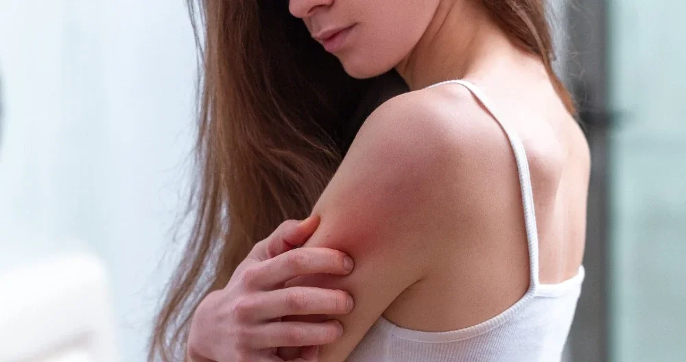 New study reveals why you shouldn’t scratch an itchy rash