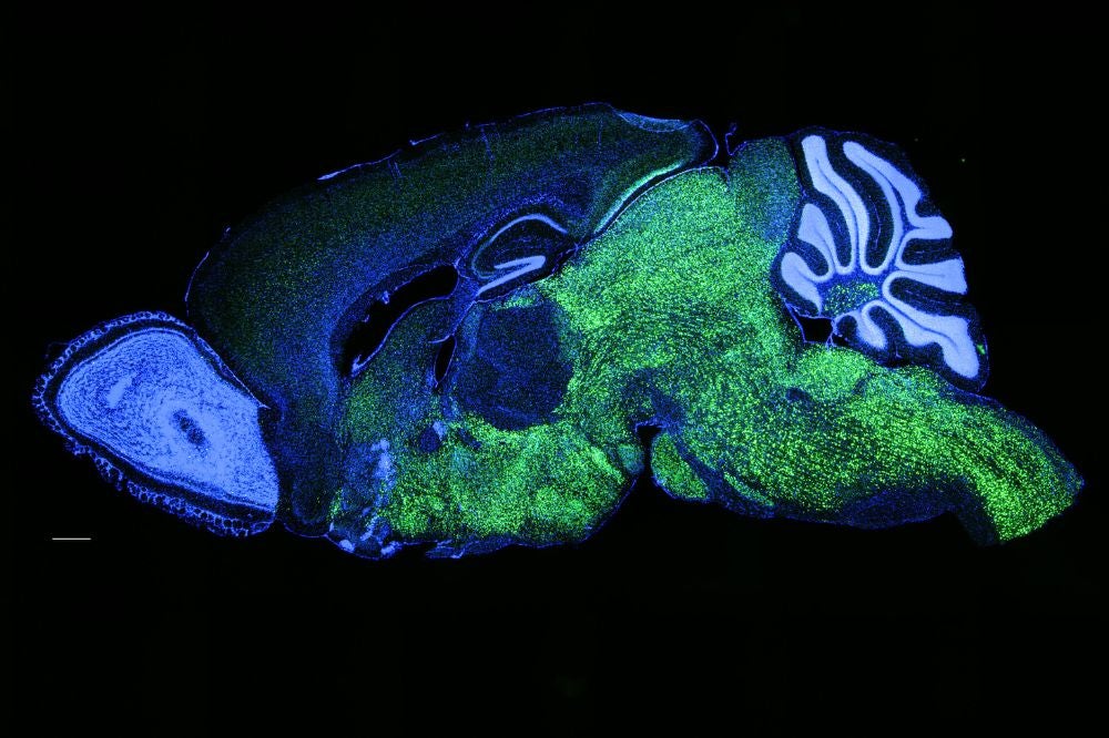 Expression pattern of NOVA1 in the brain of a mouse. NOVA1 in green, nuclei (DAPI) in blue. 