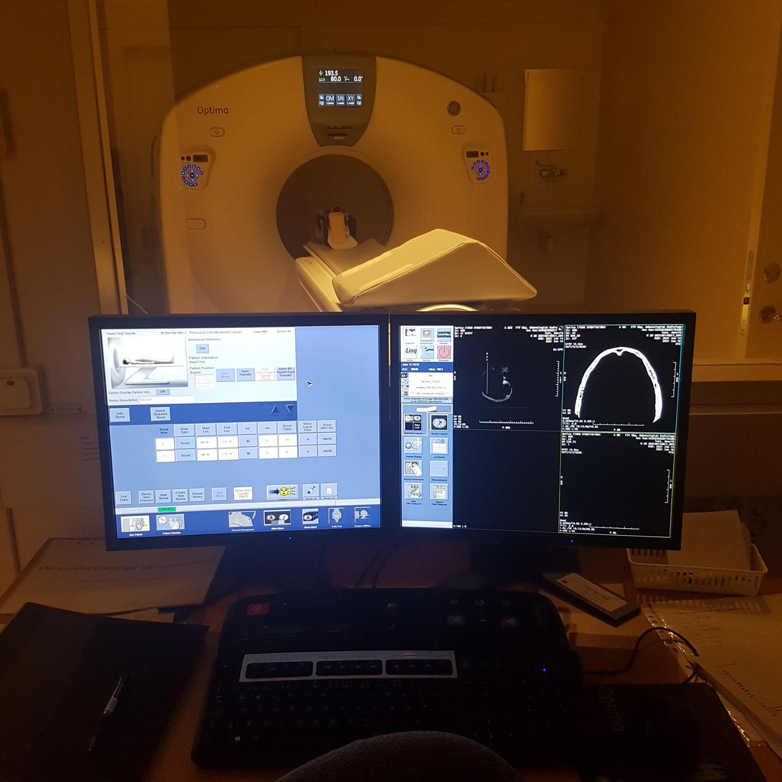 Computed tomography provide 3D photos and the possibility of advanced image analysis where layer by layer of bones, jaw bones and teeth are studied in detail.