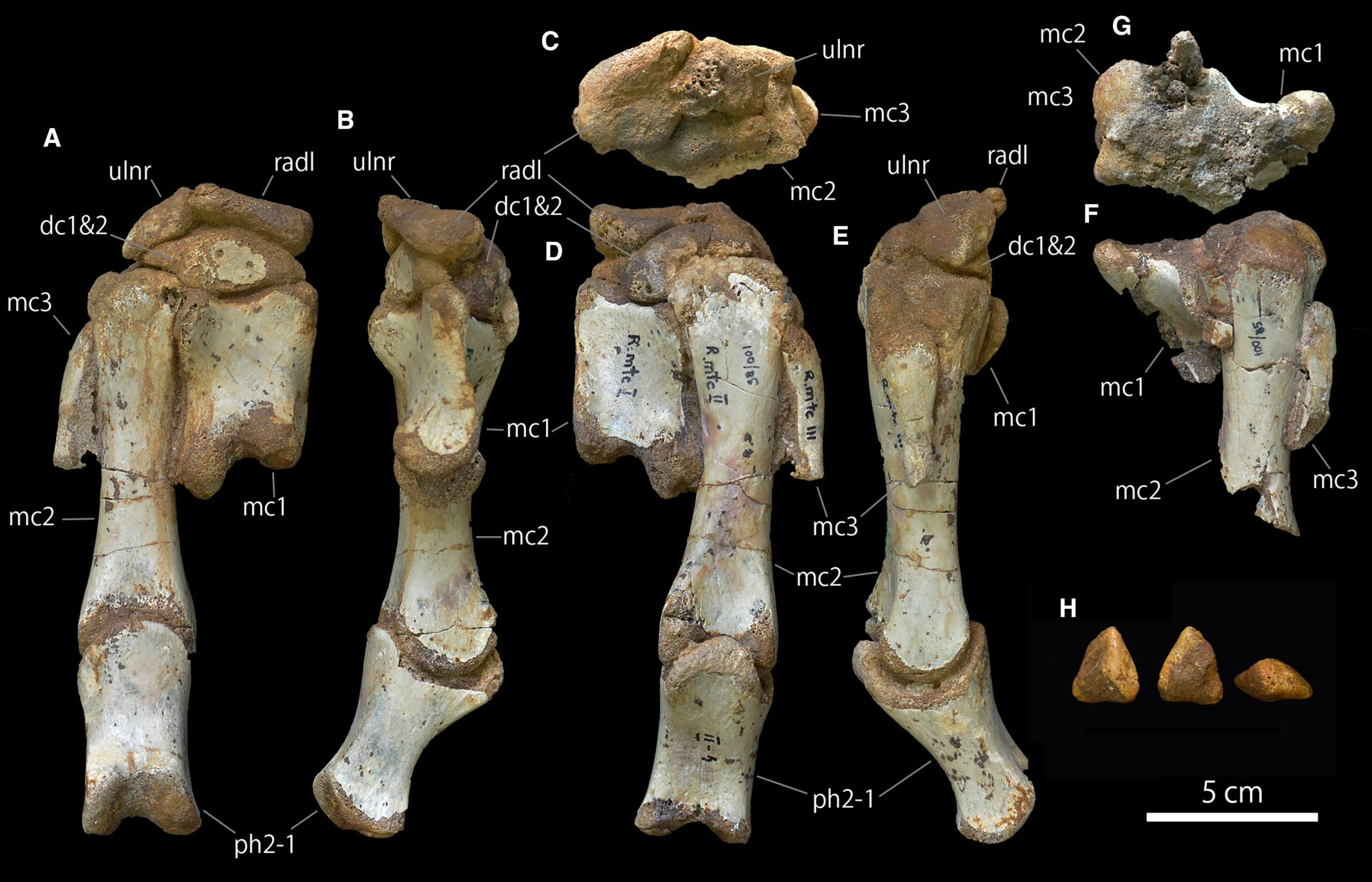 Distal carpals and metacarpals of Duonychus tsogtbaatari gen. et sp. nov.