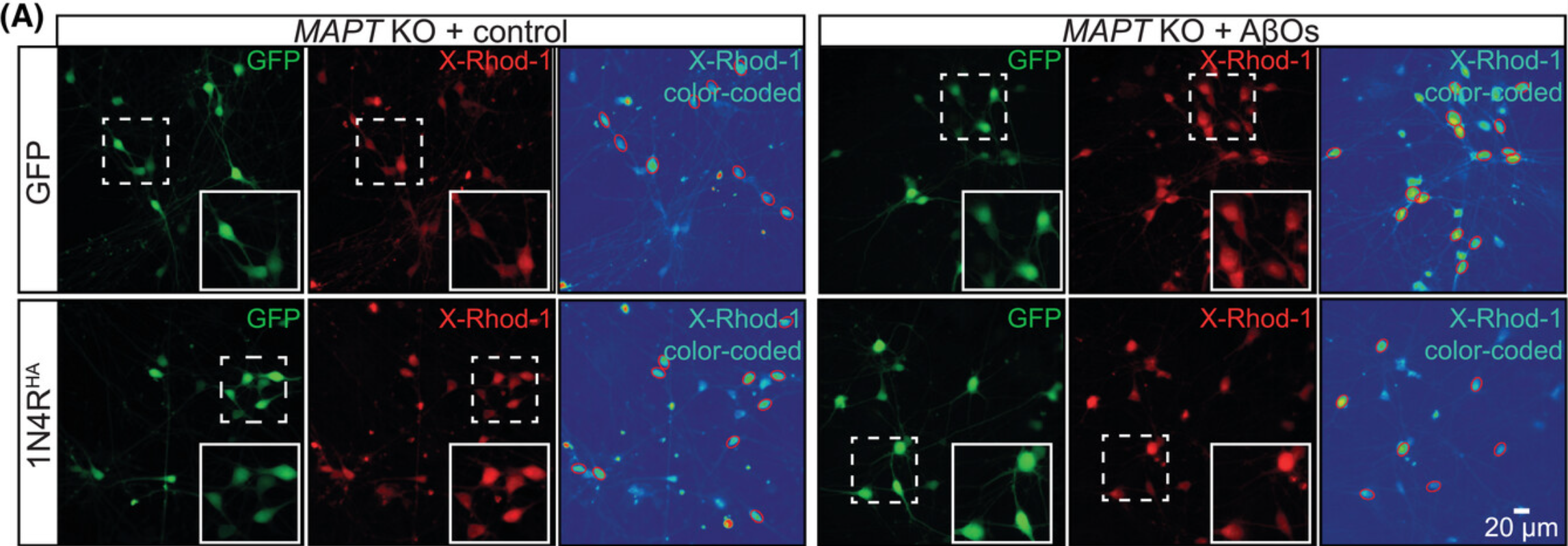 Representative images of tau KO iNeurons (d21) expressing either GFP (upper panels) or GFP together with 1N4R tau (lower panels).