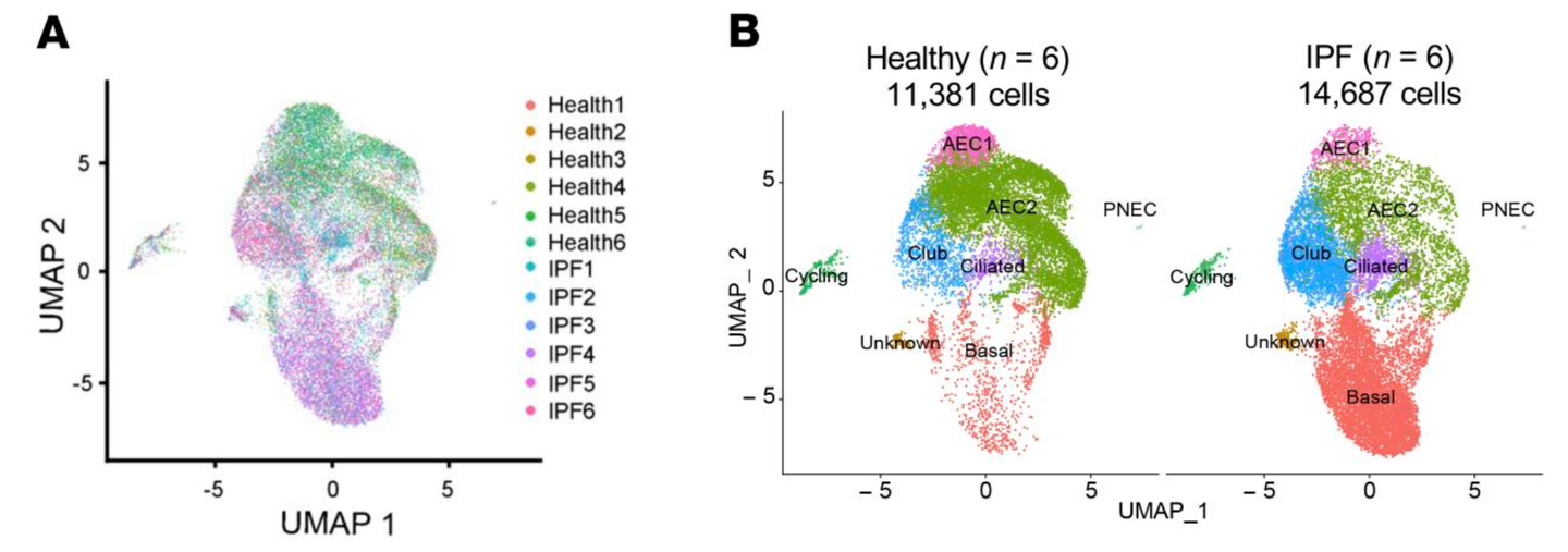 UMAP plots of flow-enriched EpCAM+CD31–CD45– cells from healthy (11,381 cells, n = 6) and IPF lungs (14,687 cells, n = 6).