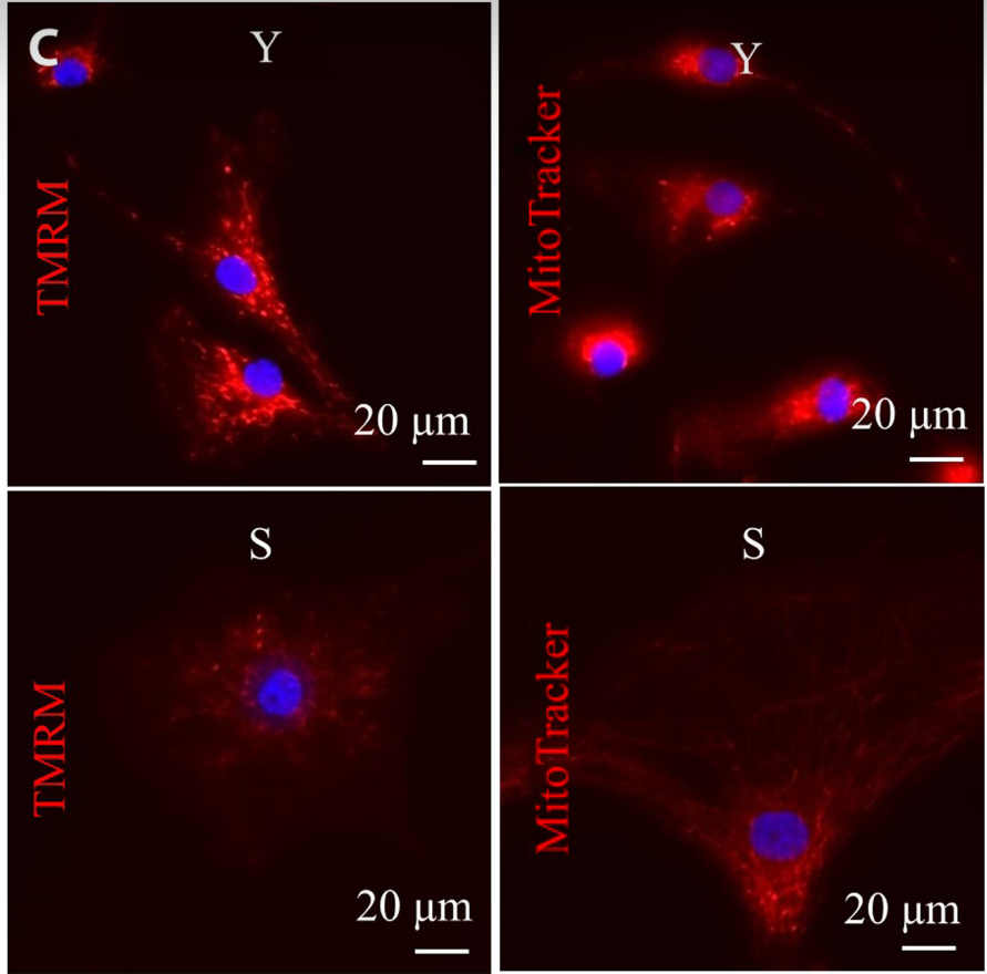 Representative images of tetramethylrhodamine methyl ester (TMRM) and MitoTracker live stains corresponding to mitochondrial Δψ.