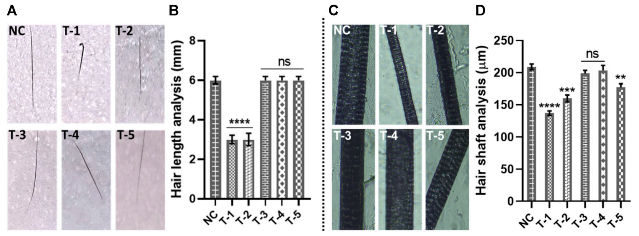 Gross analysis of hair: (A) digital photographs of hair length, (B) hair length analysis of skin sections from different treatment groups. Results are presented as n = 60 + SD; ****p ≤ 0.0001 denotes NC versus T-1 and T-2; ns p > 0.05. (C) Photographs of hair shafts from different treatment groups. (D) Hair shaft analysis of skin sections from different treatment groups.