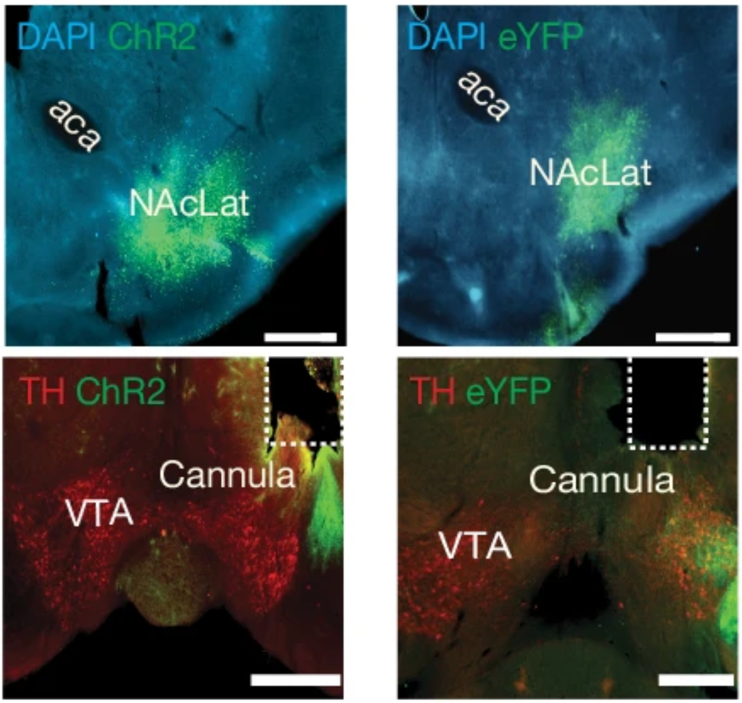 Fluorescence images showing ChR2 or eYFP expression in the NAcLat (top) and VTA (bottom). 